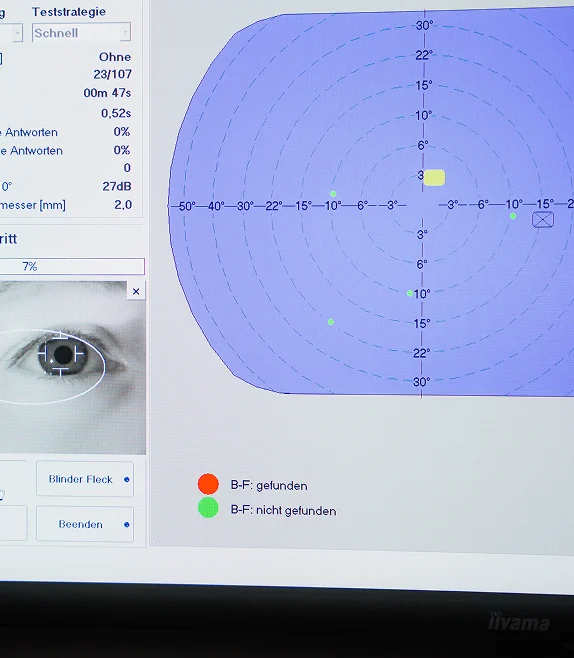 Diagnosetool zur Überprüfung des Gesichtsfelds mit grafischer Auswertung und Ergebnissen.